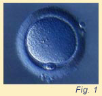 Fig. 1 Female oocyte