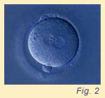 Fig.2 Fertilized oocyte (zygote), there are 2 male and female pronuclei in the center of oocyte